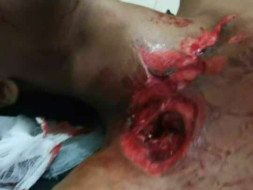 Help Me Recover From Accident