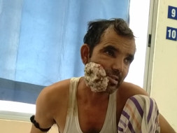 Help Kamrul Fight Mouth Cancer