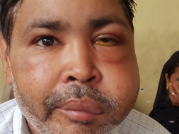 Help Neeraj Recover From Lymphoma
