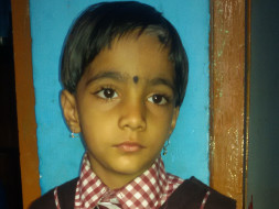 Support My Daughter Under go Cochin Implant Surgery.