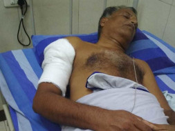 Help My Uncle Undergo Reduction Surgery.