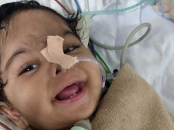 Help Baby Danasri To Overcome Tracheobronchomalacia.