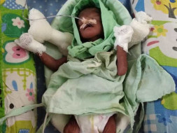 Help Shubhangi to Save 26 weeks Pre-mature Twins! (Only One Survived)