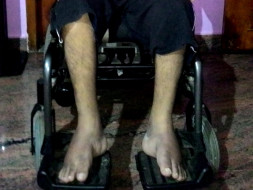 Please help me to fight against motor neurone disease(ALS)