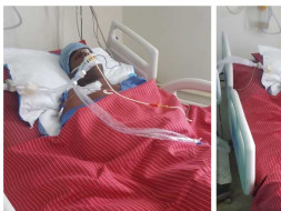 Help Kishore Kumar from Brain Clotting
