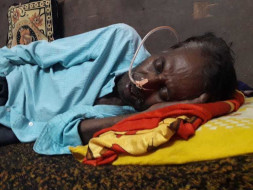 Help Lakshmi Narayanappa Fight Tongue Cancer