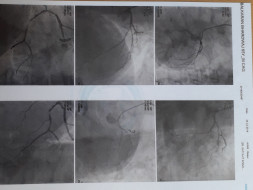 Help Me Undergo Heart Surgery