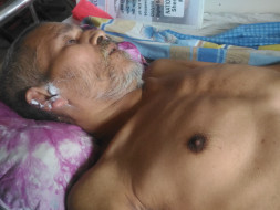Help My Uncle Faraque To Recover From Pott's Disease.