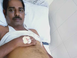 Help Me Get My Liver Transplantation Done