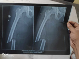 Help My Friend Who Met With Accident