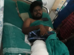 Poovendran leg fracture