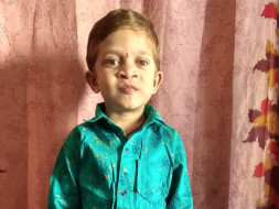 Help 6-Year-Old, Pavan From Rare Disease - Hermansky Pudlak Syndrome