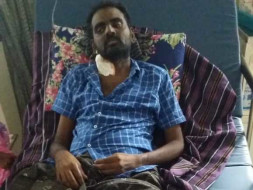 Help Nagoor Babu Fight Multi Organ Failure