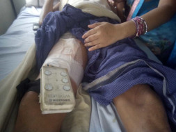 Help My Brother Fight Cardiac Disease & Hepatitis b
