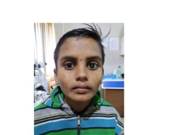 Help Sunil who cannot Speak nor Hear for his Eye Surgery