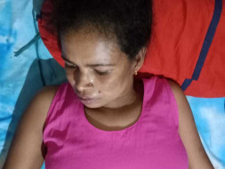 Help My Sister Fight Epilepsy