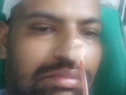 Help My Brother Nusrat Undergo Brain surgery