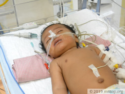 Help Pooja's Baby Fight Viral Bronchopneumonia