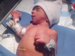 Help My Premature Baby Son To Recover From ICU