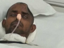 Help My Uncle Who Met With Road Accident