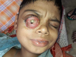 Help My 12 Years Old Son Vansh Fight Cancer.