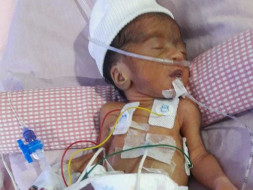 Help Premature Born Roja Fight For Life!