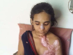 Help khushi fight to live with dignity