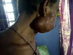 Help My Father To Fight Cancer