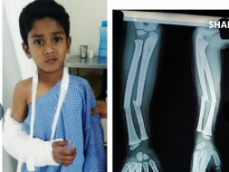 Help My Brother Recover From Fatal Accident