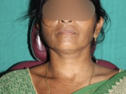 Help Purna To Recover From Trauma of an Accident