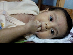 Help 11 Month Old Sharwin Undergo A Bone Marrow Transplant