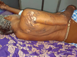 Help Rajendra Recover From An Accident!