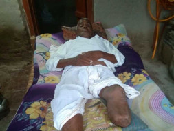 Help My Grandfather Undergo Surgery