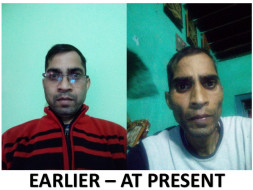 Help Me Fight Against Liver Cancer