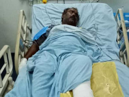 Help My Uncle Recover From Multiple Skull and Facial Bones Fracture