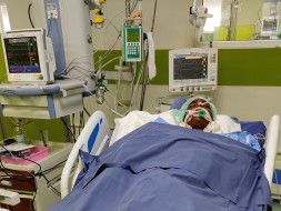 Antony HEPATITIS AND ACUTE KIDNEY INJURY