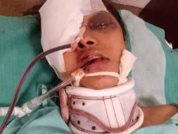Help My Friend Krithika From An Accident