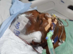 Please Save My Brother Nagaraj From Multiple Organ Failure!