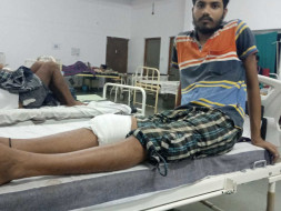 Help them He has a broken leg in an accident