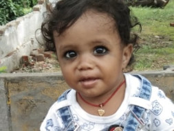 Arya is suffering from Club Foot abnormalities. Help him get operated.