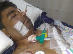 Help My Husband To Fight With Tongue Cancer