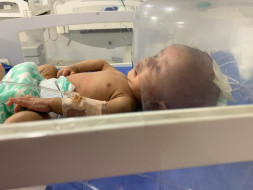 Help 2 Months Old Mahad Recover From Hypercephalus