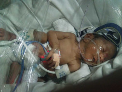 Help a 7 month Premature Baby Girl struggling for Life in NICU