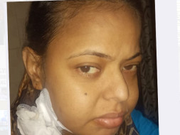 Help My Sister Anshu Pandita Undergo A Kidney Transplant