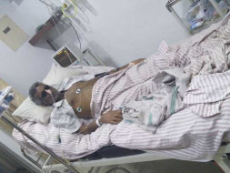 Help Sundaram Fight Hilar Cholangiocarcinoma - Type 3