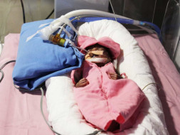 Please Help Our 2 Month Old Daughter Undergo A Heart Surgery!