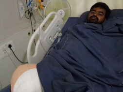 Help my friend Undavalli Nagendra Babu fight Road traffic accident