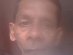 Support Bylappa fight Tongue cancer