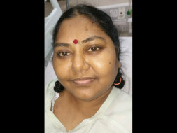 Help my mother suffering from Brain tuberculosis