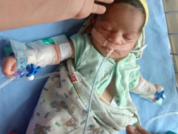 Help 9 Days Old, Rupali Ishwar From Suffering Heart Ailment